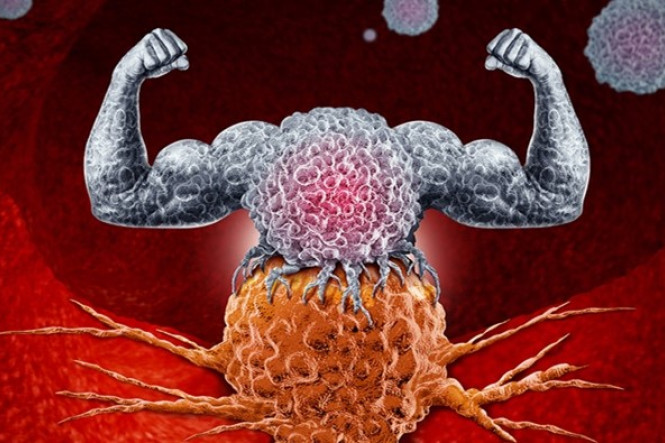 Strong immune cell representing anti-tumor immunity. Photo: KWF